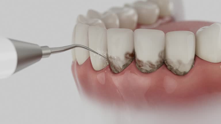 Trusted Teeth Cleaning And Checkup service in Medina, MN - Dentist Open Now